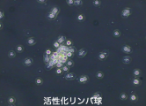 活性化リンパ球の顕微鏡写真